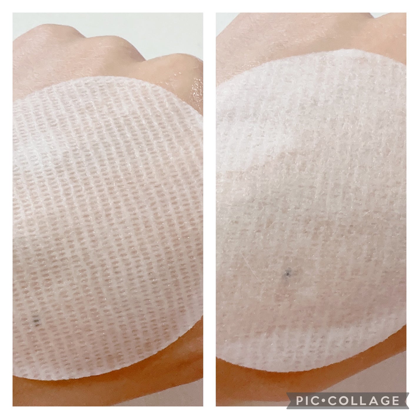 シカメタルカーミングパッド/Dr.Different/トナーパッドを使ったクチコミ(5枚目)