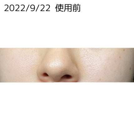 酵素洗顔パウダー/ドットバスター/洗顔パウダーを使ったクチコミ(3枚目)