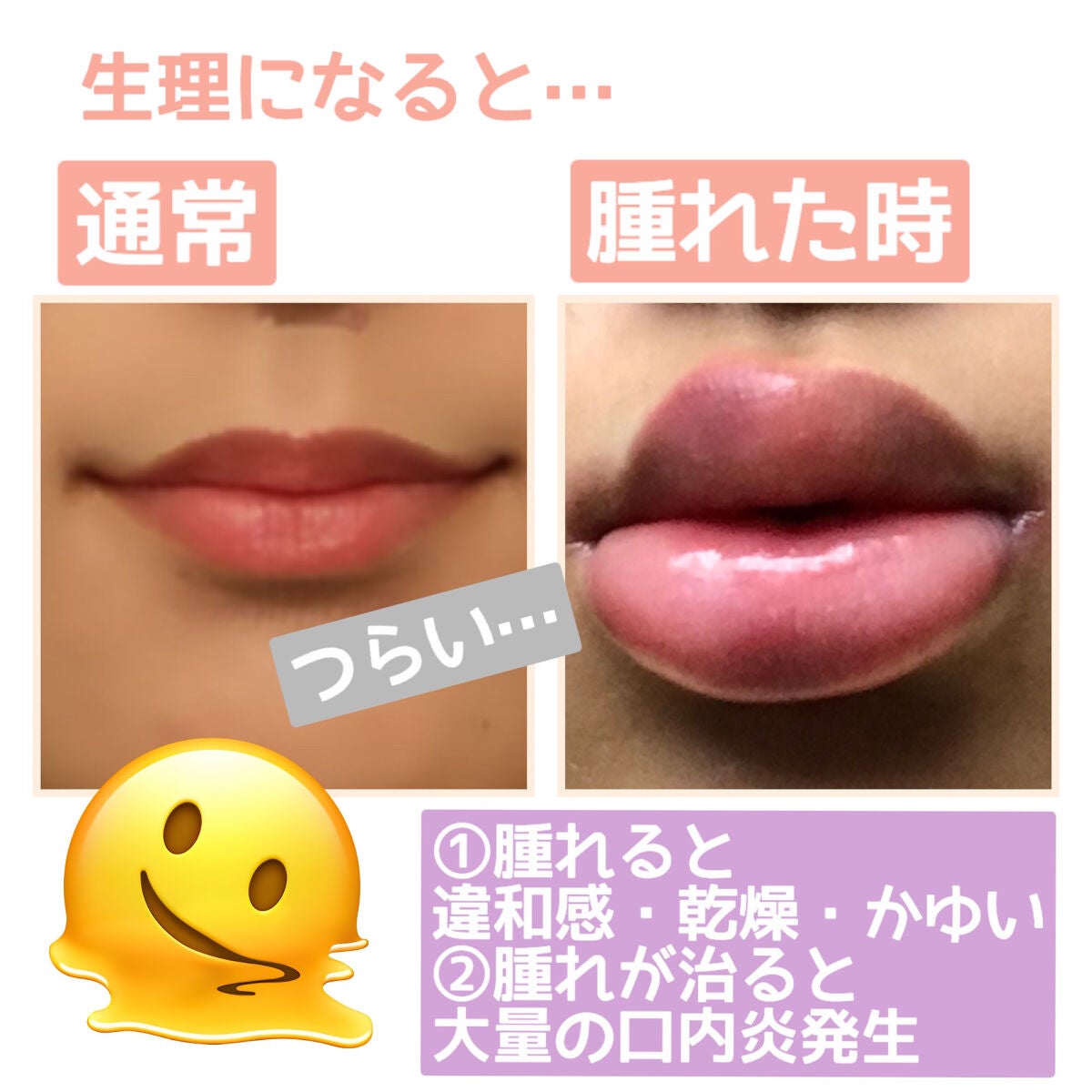 ノーシンピュア(医薬品)/アラクス/その他を使ったクチコミ(2枚目)