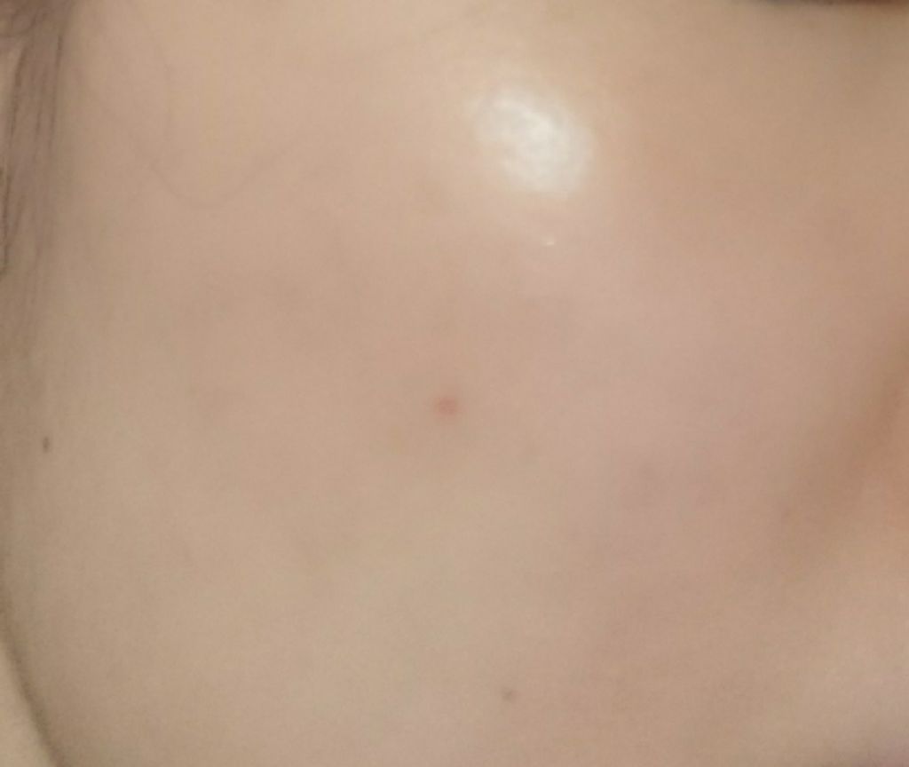 プロポリス エネルギーアンプル/CNP Laboratory/美容液を使ったクチコミ(2枚目)