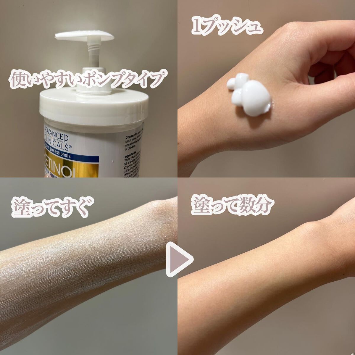 レチノールアドバンスドファーミングクリーム/ADVANCED CLINICALS/ボディクリームを使ったクチコミ(3枚目)