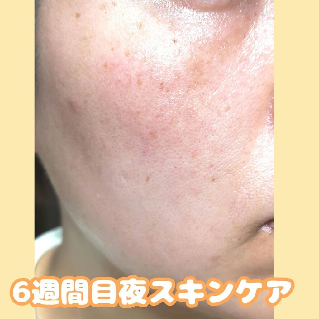 アレルバリア エッセンス BB/d プログラム/BBクリームを使ったクチコミ(4枚目)