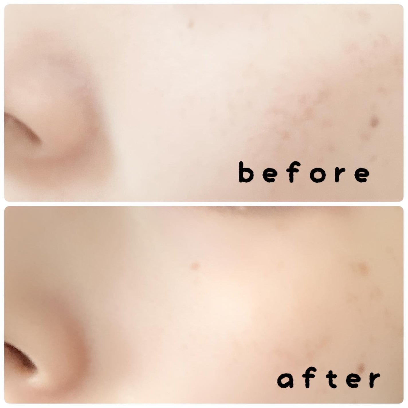 リードルショット300/VT/美容液を使ったクチコミ(7枚目)