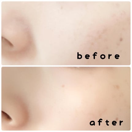 リードルショット300/VT/美容液を使ったクチコミ(7枚目)