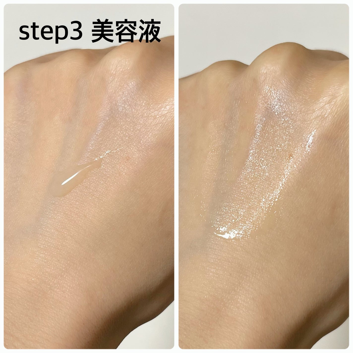 アンプルール トライアルキット/アンプルール/トライアルキットを使ったクチコミ(5枚目)