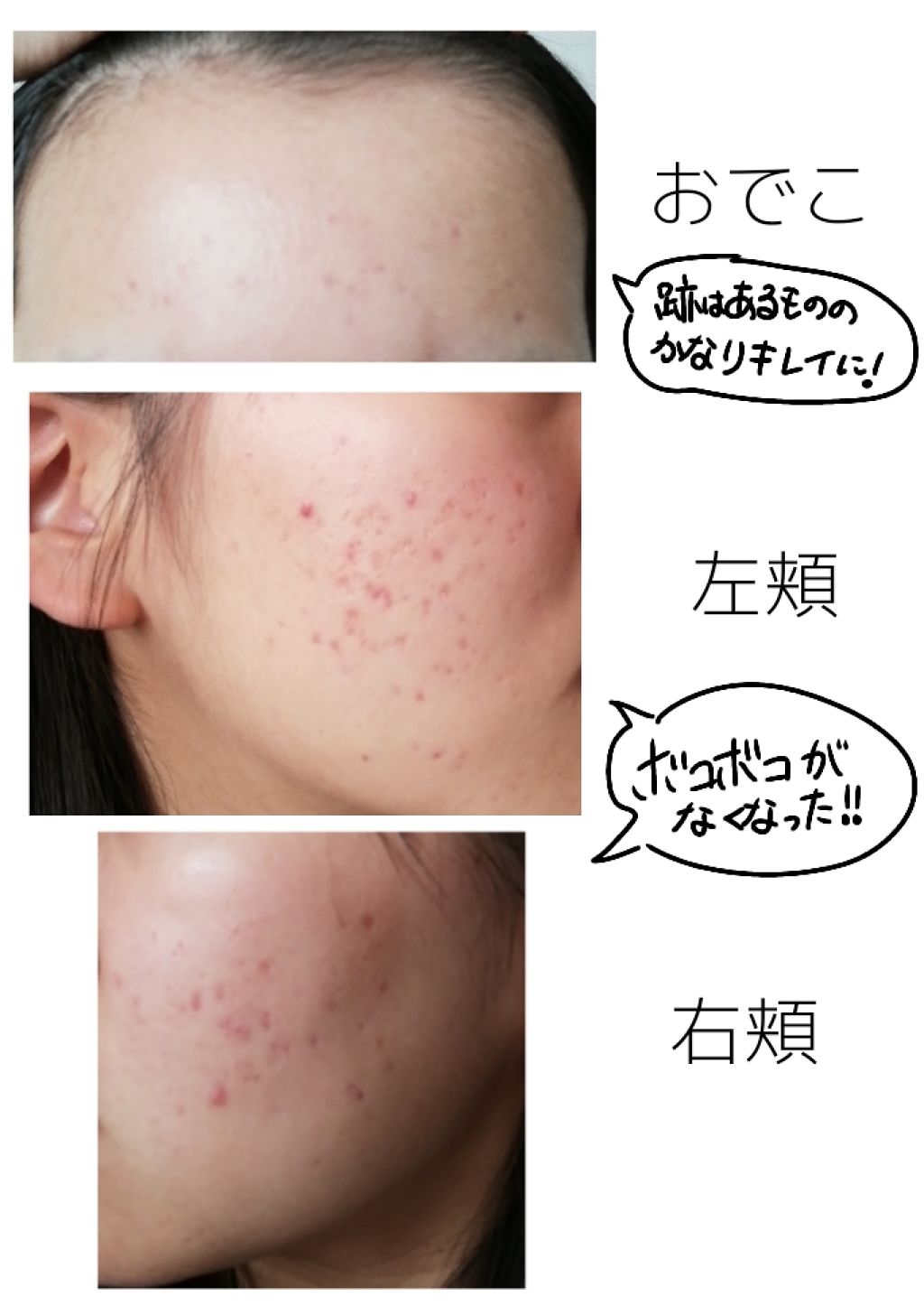 薬用 しみ 集中対策 美容液/メラノCC/美容液を使ったクチコミ（3枚目）