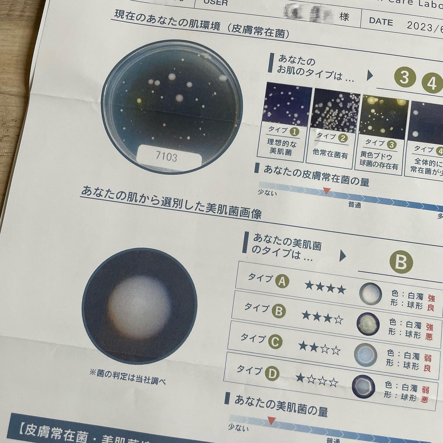 エルピダ セリア/ELPIDA/フェイスクリームを使ったクチコミ（2枚目）