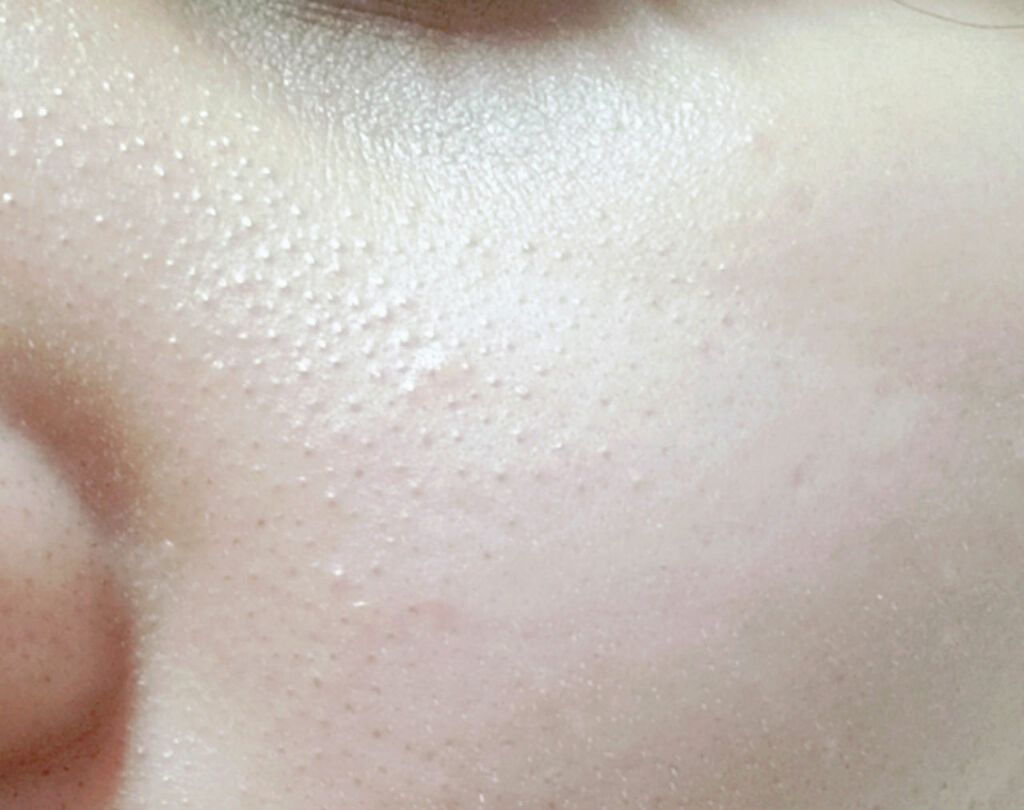 ハトムギ化粧水(ナチュリエ スキンコンディショナー R )/ナチュリエ/化粧水を使ったクチコミ(3枚目)