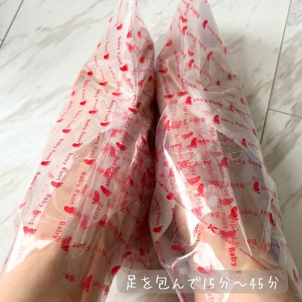 ベビーフット 重曹殺菌消毒洗浄剤/ベビーフット/レッグ・フットケアを使ったクチコミ(5枚目)