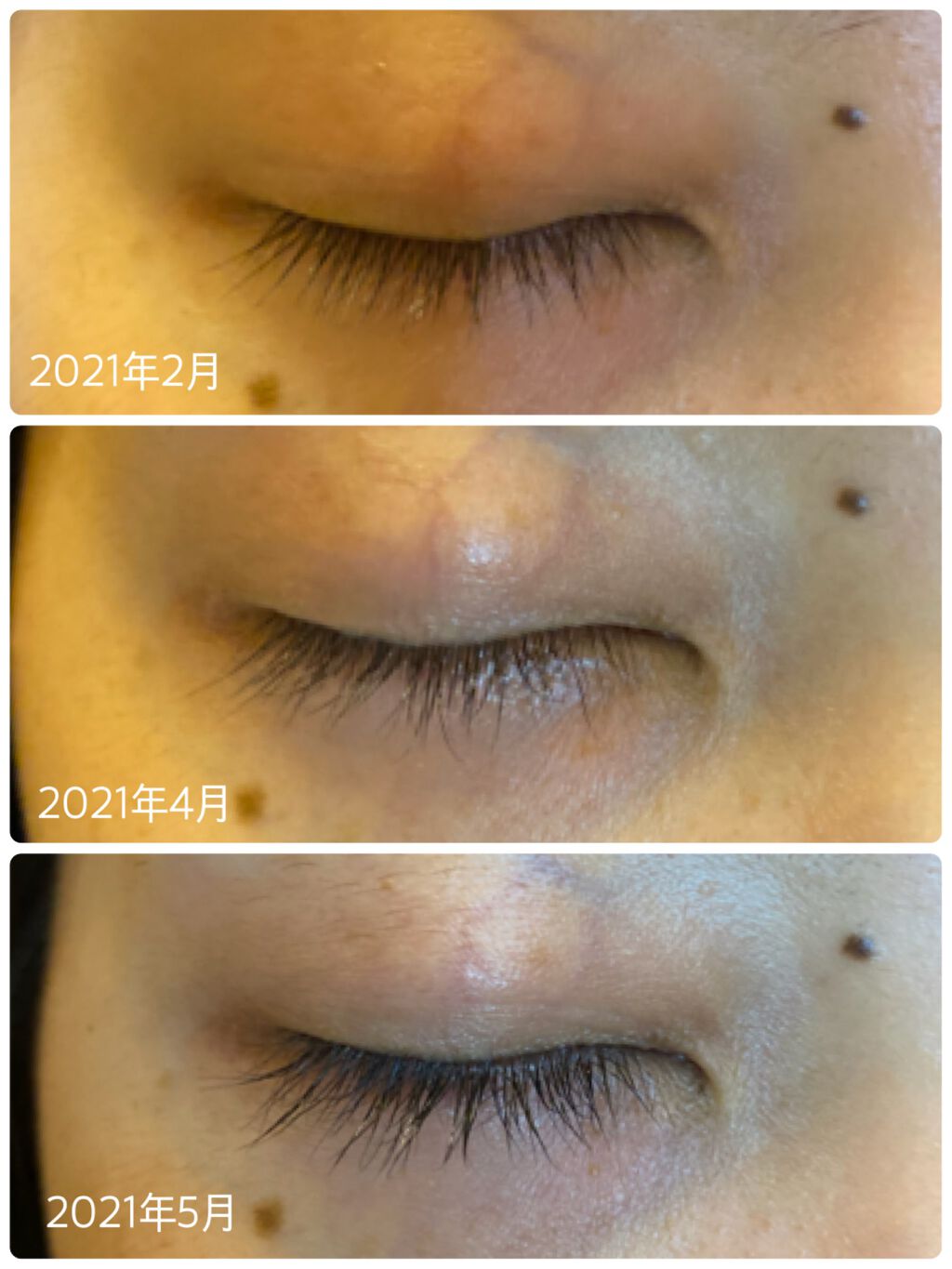 ラッシュアディクト アイラッシュコンディショニングセラム/soaddicted/まつげ美容液を使ったクチコミ(1枚目)