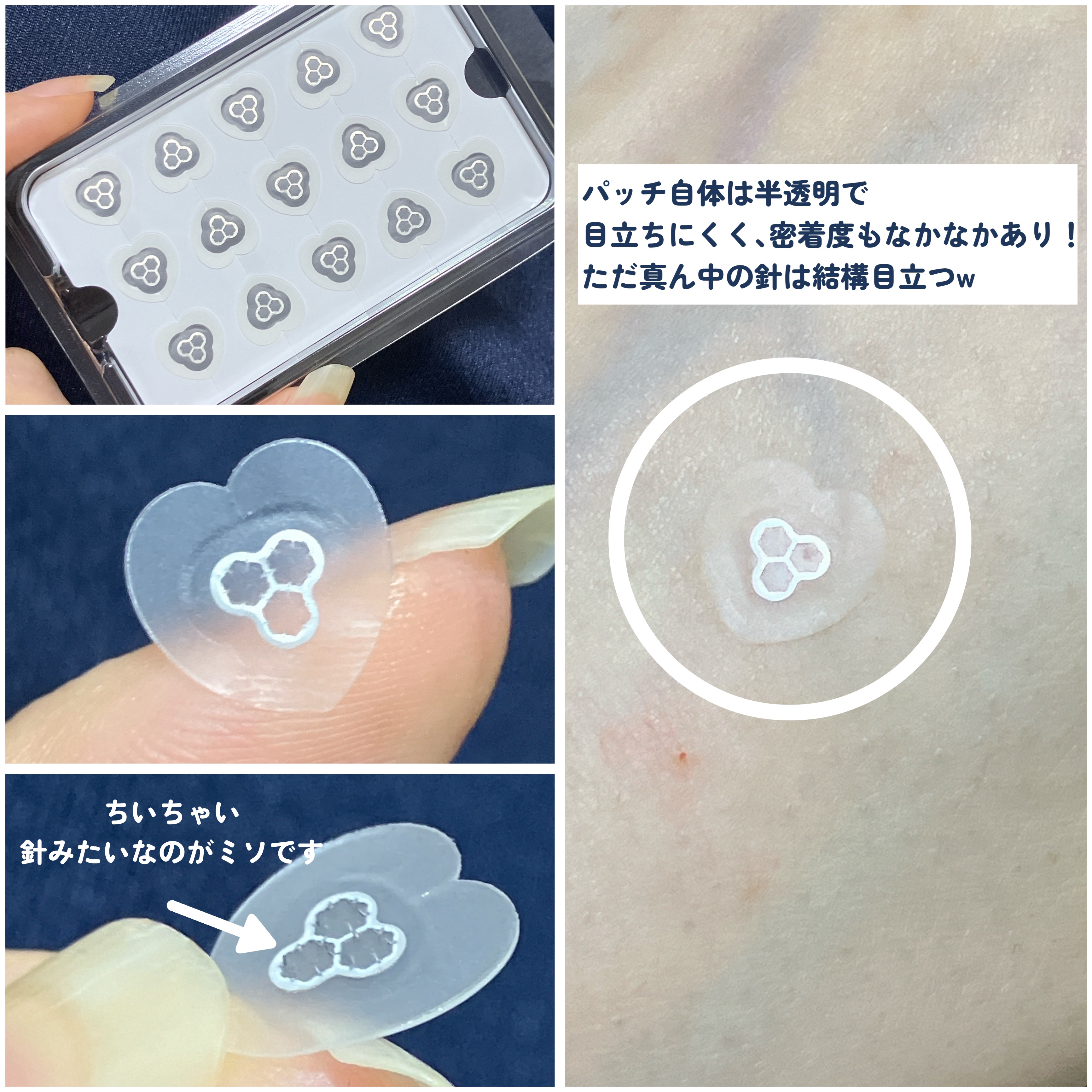 ACマグネシウムパッチ　ミニ/スノーツープラス/にきびパッチを使ったクチコミ（3枚目）