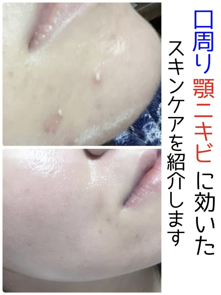 ミルクブライトニングトナー/MEDIHEAL/化粧水を使ったクチコミ（1枚目）