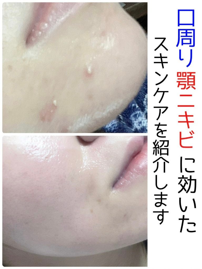 ミルクブライトニングトナー/MEDIHEAL/化粧水を使ったクチコミ(1枚目)