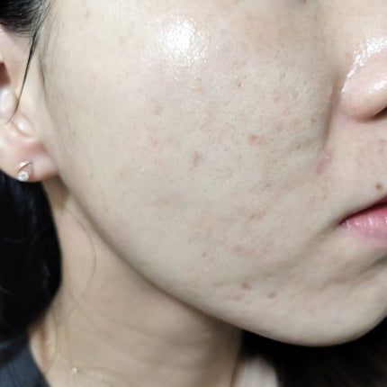 マデカソ 美容液/A’pieu/美容液を使ったクチコミ(1枚目)