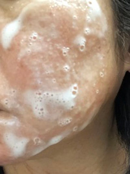 ソフィーナ iP リニュー ムース ウォッシュ/SOFINA iP/洗顔フォームを使ったクチコミ(3枚目)