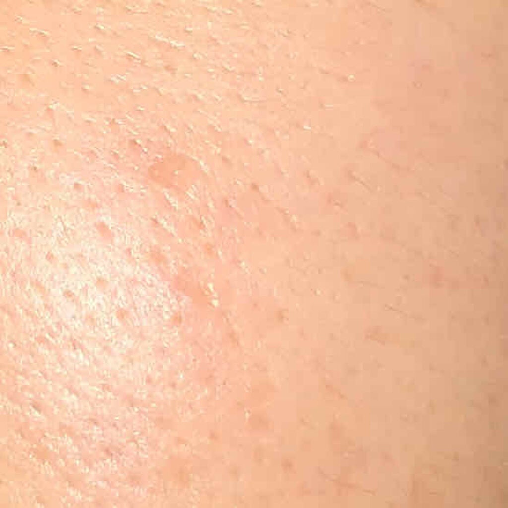 ネイチャーコンク 薬用クリアローション/ネイチャーコンク/拭き取り化粧水を使ったクチコミ(2枚目)