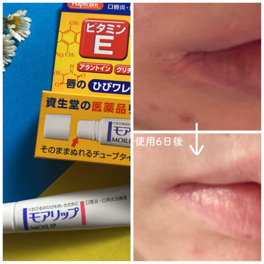 モアリップ N (医薬品)/資生堂薬品/その他を使ったクチコミ（3枚目）