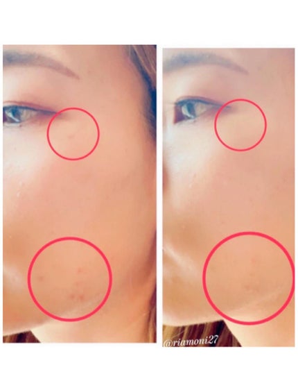 モイストラボ エッセンス薬用美白コンシーラー/Moist Labo/リキッドコンシーラーを使ったクチコミ(4枚目)