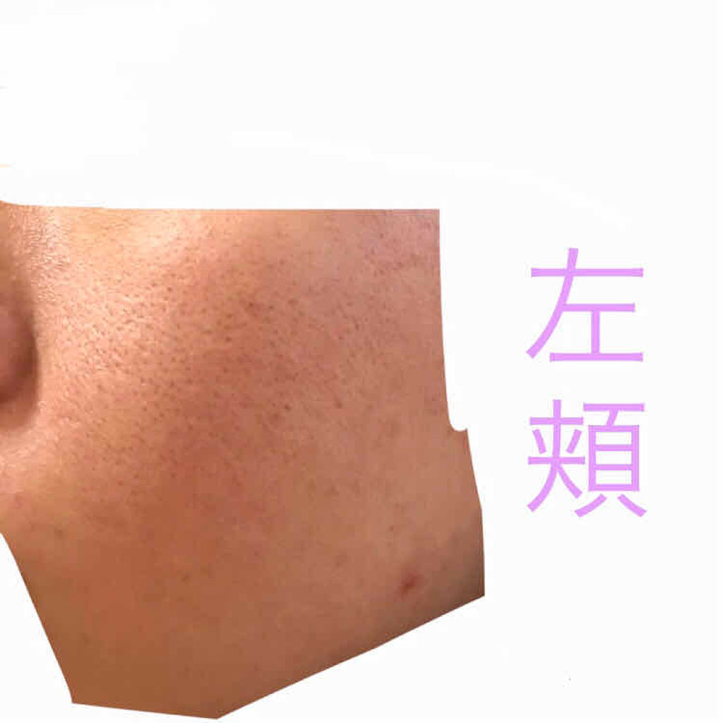 ロゼット洗顔パスタ アクネクリア/ロゼット/洗顔フォームを使ったクチコミ（2枚目）