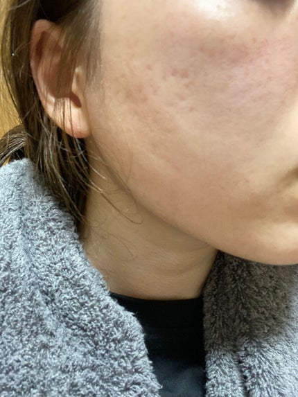 モイスチャー リッチローション(とてもしっとり)/アルージェ/化粧水を使ったクチコミ(2枚目)