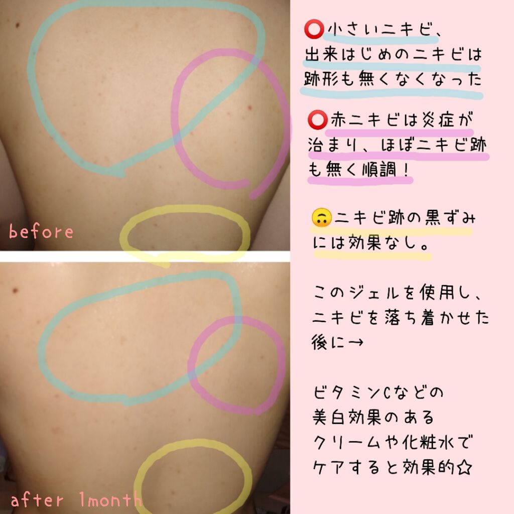 薬用スキンコンディショニングゲル/オードメディカ/オールインワン化粧品を使ったクチコミ(1枚目)