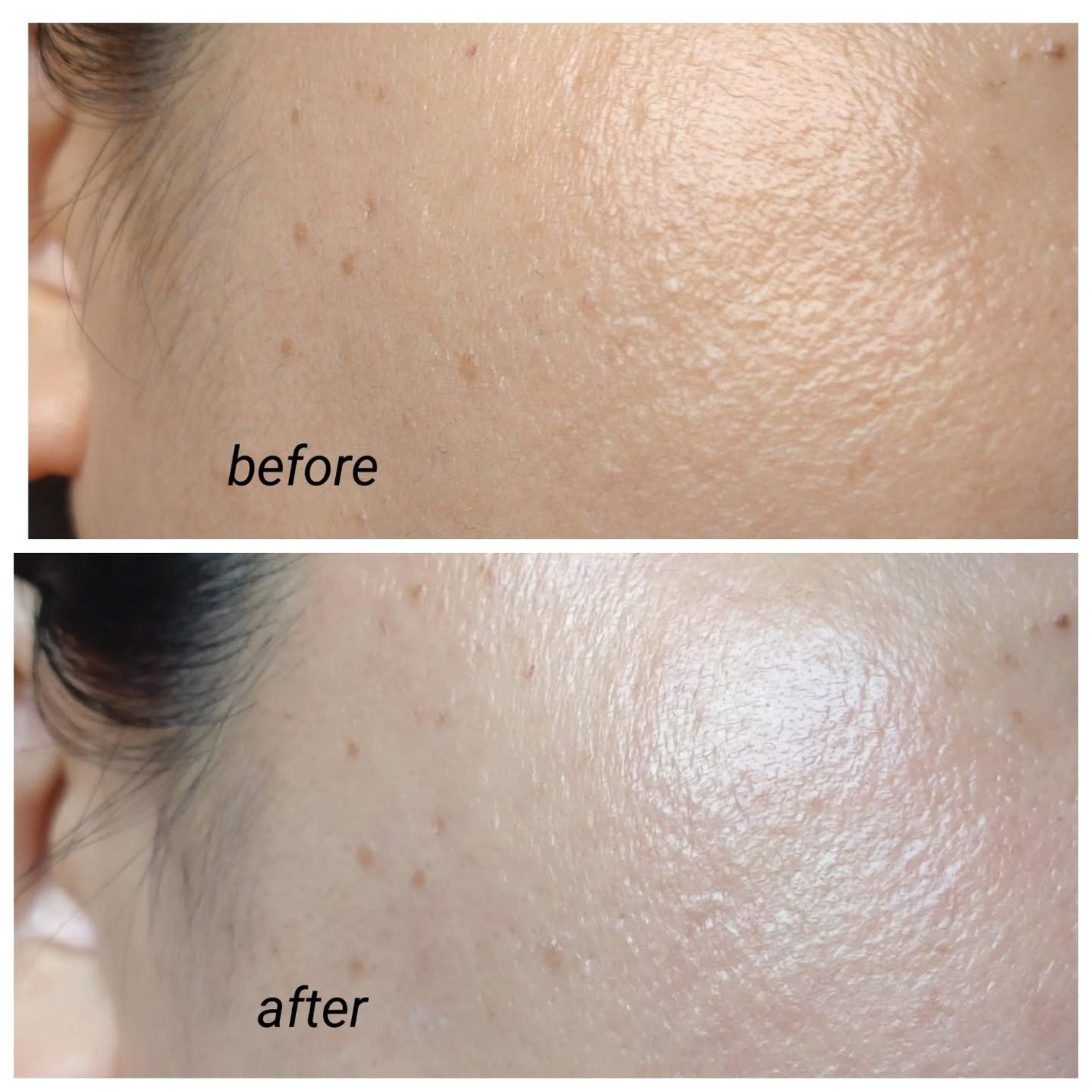 PDRNショット675/COSNORI/美容液を使ったクチコミ(7枚目)