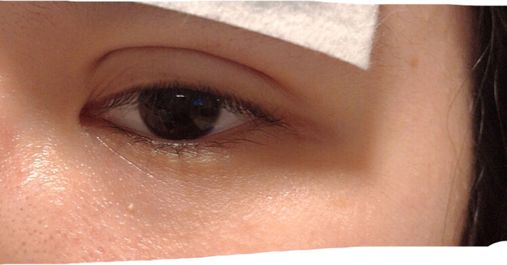 のびーるアイテープ（絆創膏タイプ、レギュラー）/DAISO/二重まぶた用アイテムを使ったクチコミ（2枚目）