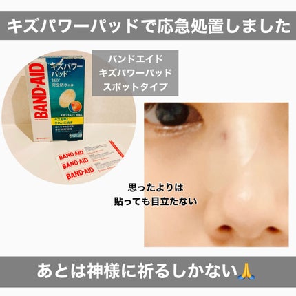 キズパワーパッド/バンドエイド/その他を使ったクチコミ(3枚目)
