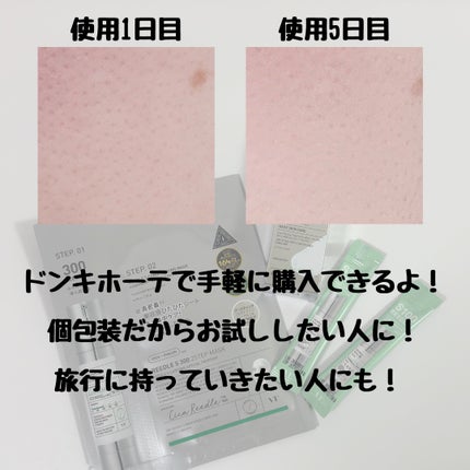 リードルS 100 2ステップマスク/VT/シートマスク・パックを使ったクチコミ(6枚目)