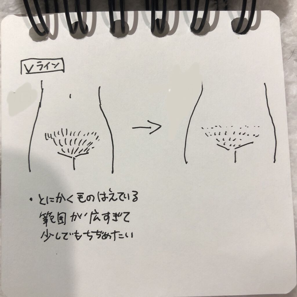 光美容器KE-NON（ケノン）/エムテック/家庭用脱毛器を使ったクチコミ（3枚目）