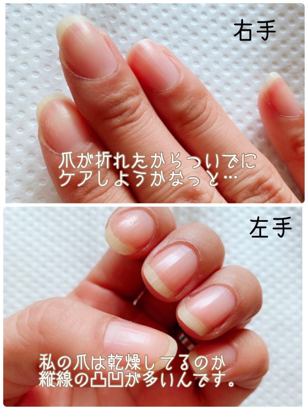 キューティクルリムーバーⅡ/デュカート/ネイルオイル・トリートメントを使ったクチコミ(2枚目)