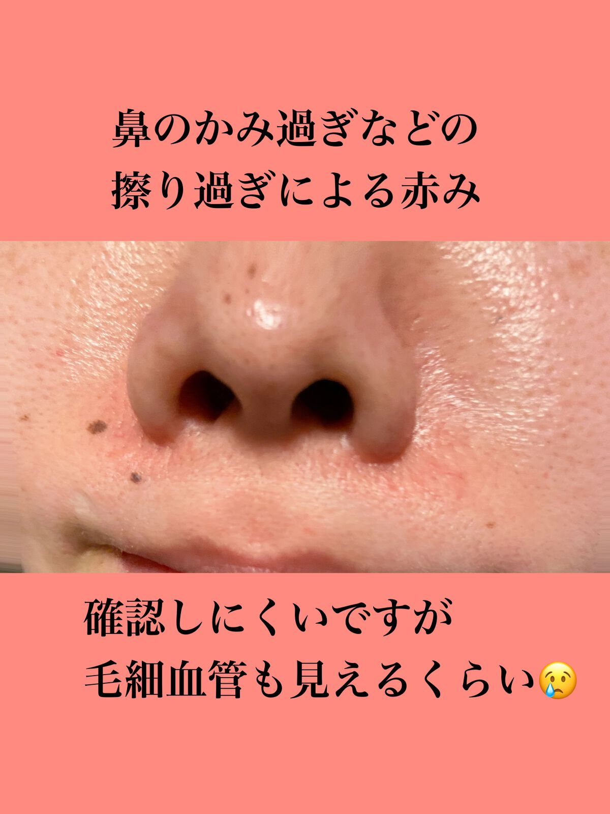 スーパーベーシック リクイドコンシーラー N 02/RMK/リキッドコンシーラーを使ったクチコミ（3枚目）