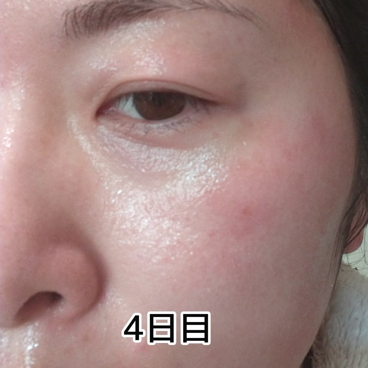 ヨナ フォロバ100 on LIPS 「MARKAIDハイドスピキュールクリーム15g使用して4日経ち..」(4枚目)