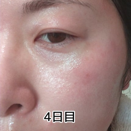 ヨナ フォロバ100 on LIPS 「MARKAIDハイドスピキュールクリーム15g使用して4日経ち..」(4枚目)