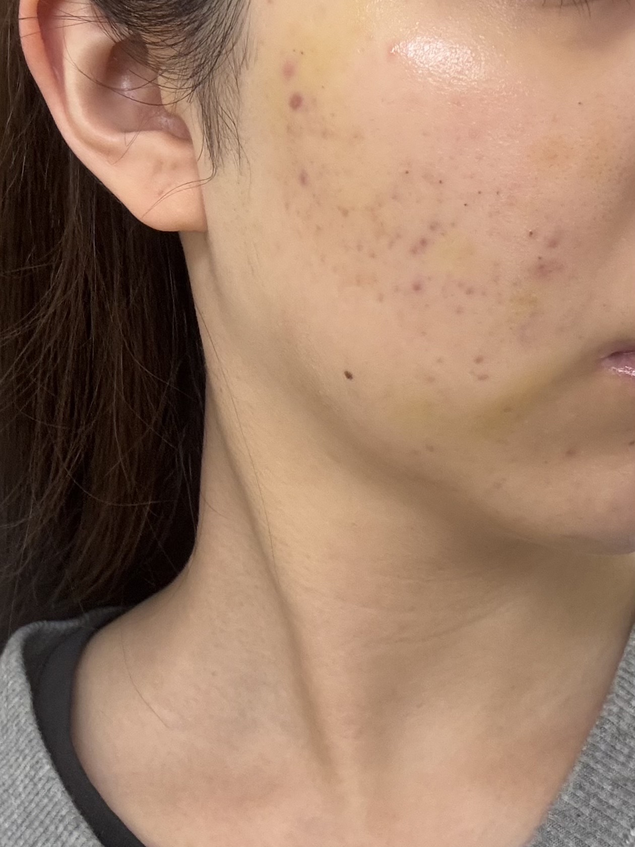 浸透湿潤セラミド１０％★ナノエマルジョン/TOUT VERT/乳液を使ったクチコミ（1枚目）