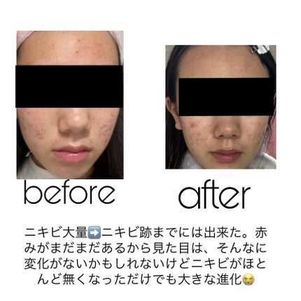 CICA デイリースージングマスク/VT/シートマスク・パックを使ったクチコミ(5枚目)