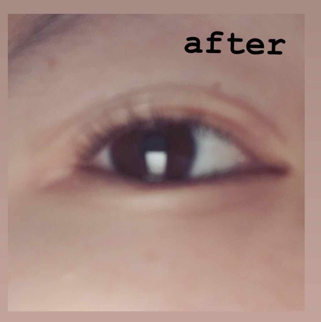 プロアイフェクトEX/プロアイフェクトEX/二重まぶた用アイテムを使ったクチコミ（3枚目）