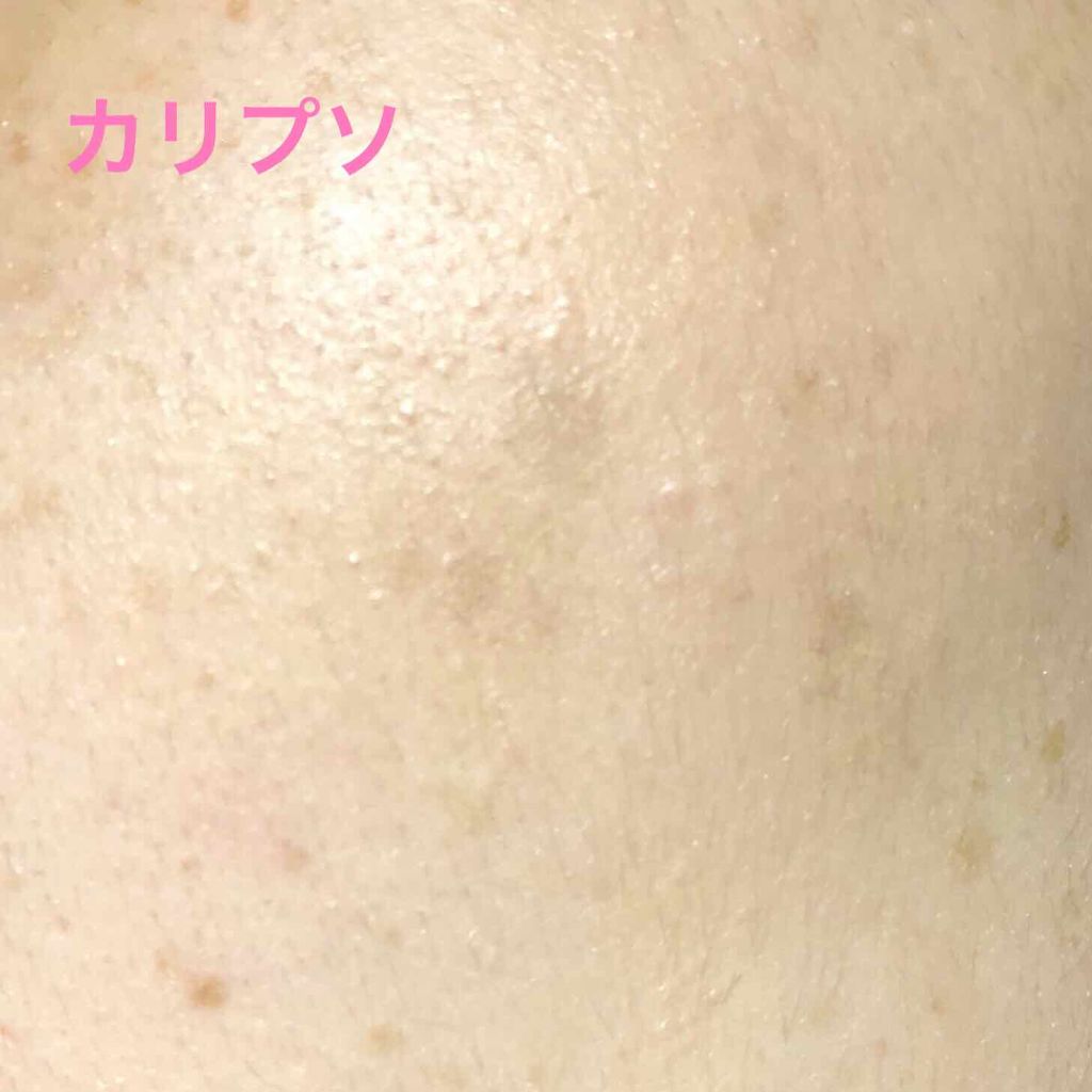 マジックコンシーラー/カリプソ/リキッドコンシーラーを使ったクチコミ（3枚目）