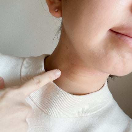 プレミアムナイテ スレッドネッククリーム/MEDIPEEL/ネック・デコルテケアを使ったクチコミ(5枚目)