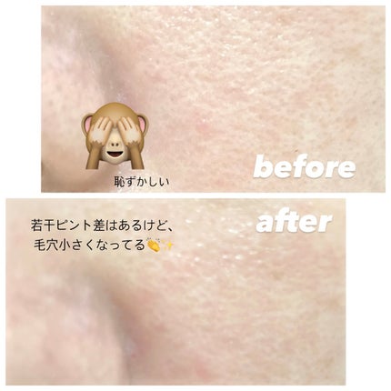 リードルショット300/VT/美容液を使ったクチコミ(5枚目)