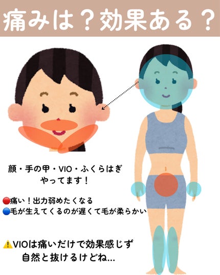 アトバリア365クリーム/AESTURA/フェイスクリームを使ったクチコミ(4枚目)