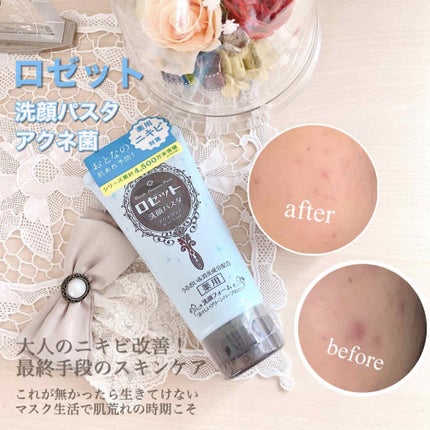 ロゼット洗顔パスタ アクネクリア/ロゼット/洗顔フォームを使ったクチコミ(1枚目)