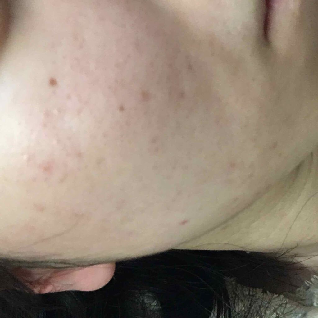 まっぷち on LIPS 「このコロナ休みで肌ピカピカにしてえ??肌めちゃ綺麗やん!!を次..」(1枚目)