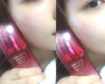 アルティミューン パワライジング コンセントレート(旧)/SHISEIDO/美容液を使ったクチコミ(1枚目)