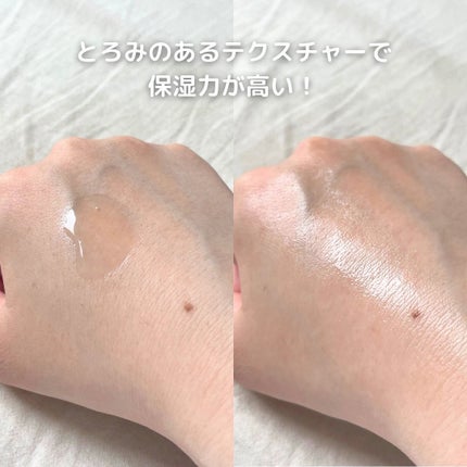 フルフィットプロポリスシナジートナー/COSRX/化粧水を使ったクチコミ(4枚目)