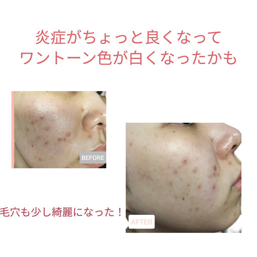 リサージ コラゲリードa/リサージ/美容液を使ったクチコミ(2枚目)