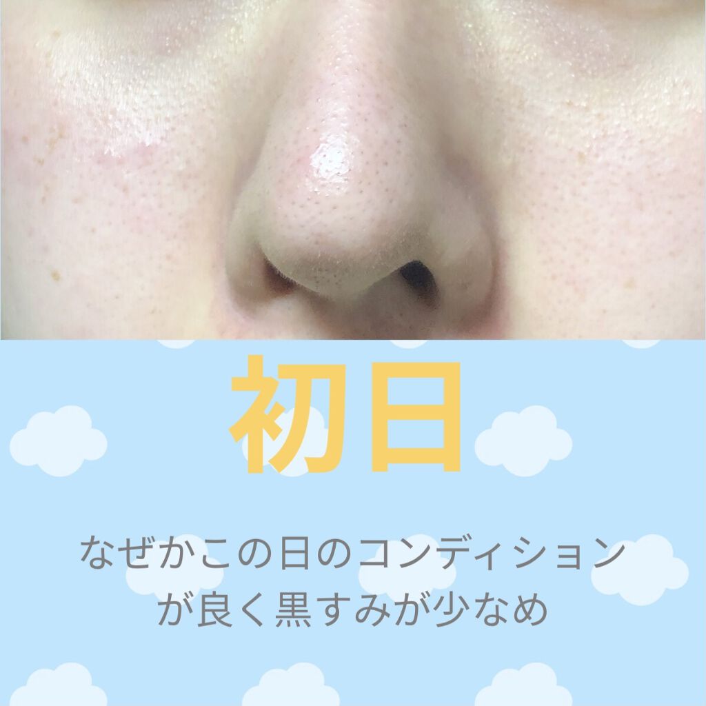 ゼロ毛穴パッド 2.0/MEDICUBE/トナーパッドを使ったクチコミ（2枚目）