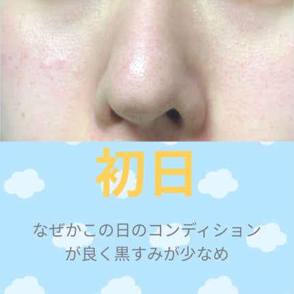 ゼロ毛穴パッド 2.0/MEDICUBE/トナーパッドを使ったクチコミ(2枚目)