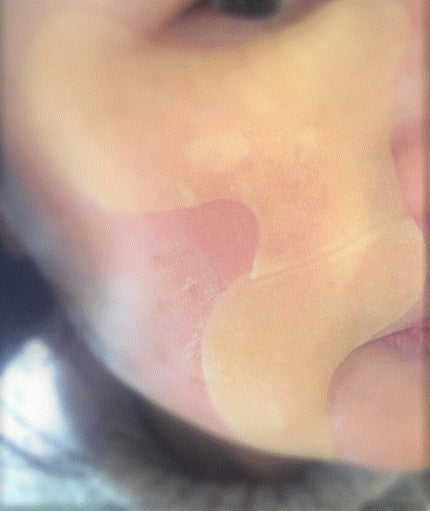 金のプラセンタ もっちり白肌濃シワトールシート/ホワイトラベル/シートマスク・パックを使ったクチコミ(3枚目)