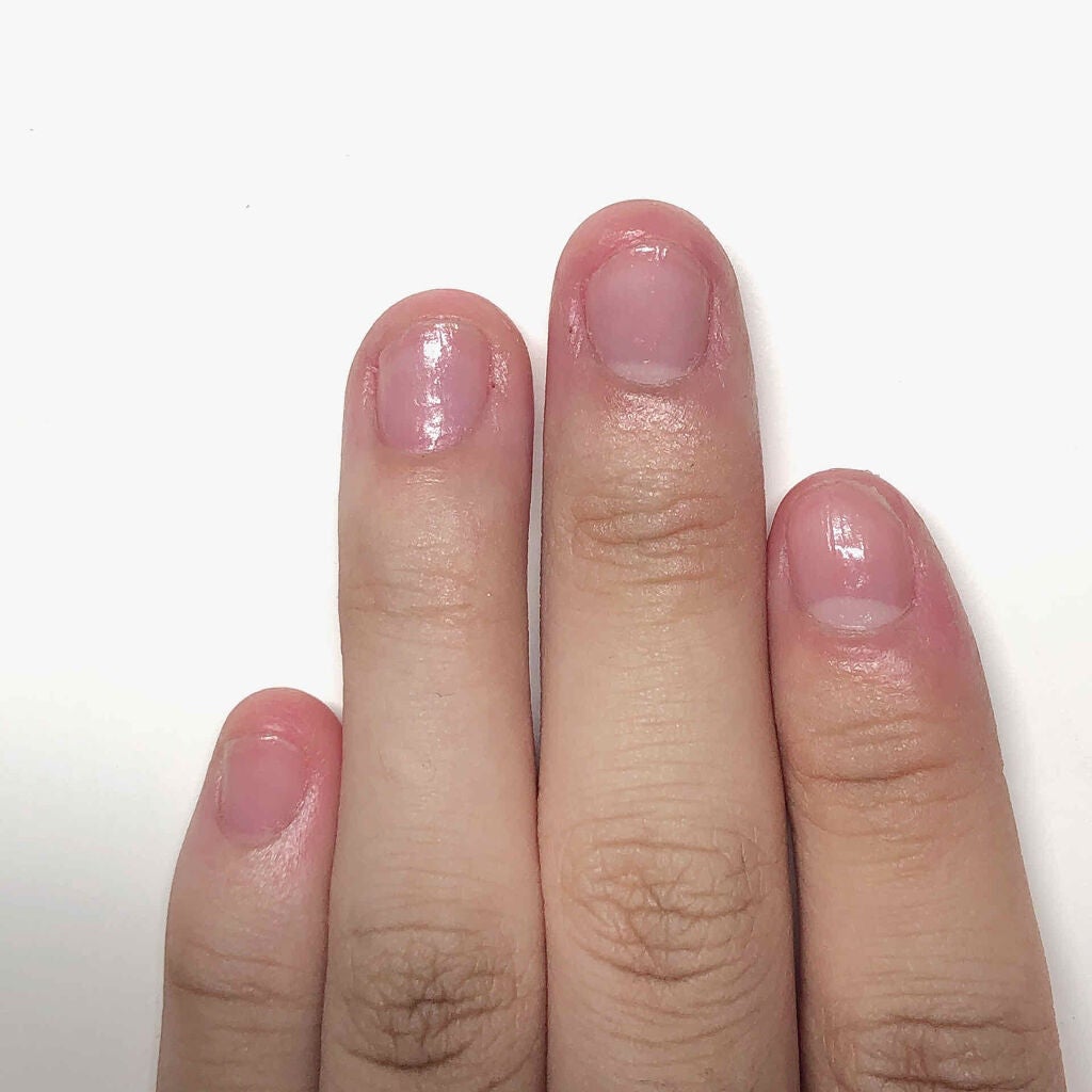 ネイルサポート Na/ネイルネイル/ネイルトップコートを使ったクチコミ(2枚目)